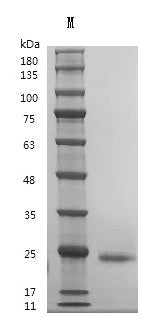 Recombinant Human Interleukin-6 (IL6) (Active) – Figure 1 of 1
