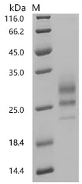 (Tris-Glycine gel) Discontinuous SDS-PAGE (reduced) with 5% enrichment gel and 15% separation gel.
