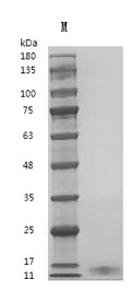 Recombinant Human Interleukin-7 (IL7) (Active) – Figure 1 of 1