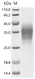 (Tris-Glycine gel) Discontinuous SDS-PAGE (reduced) with 5% enrichment gel and 15% separation gel.
