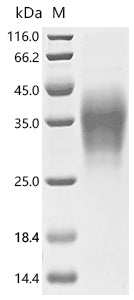 (Tris-Glycine gel) Discontinuous SDS-PAGE (reduced) with 5% enrichment gel and 15% separation gel.