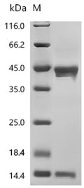 (Tris-Glycine gel) Discontinuous SDS-PAGE (reduced) with 5% enrichment gel and 15% separation gel.