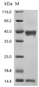 (Tris-Glycine gel) Discontinuous SDS-PAGE (reduced) with 5% enrichment gel and 15% separation gel.