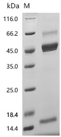 (Tris-Glycine gel) Discontinuous SDS-PAGE (reduced) with 5% enrichment gel and 15% separation gel.