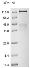 (Tris-Glycine gel) Discontinuous SDS-PAGE (reduced) with 5% enrichment gel and 15% separation gel.