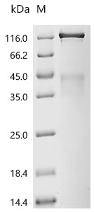 (Tris-Glycine gel) Discontinuous SDS-PAGE (reduced) with 5% enrichment gel and 15% separation gel.