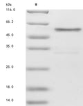 (Tris-Glycine gel) Discontinuous SDS-PAGE (reduced) with 5% enrichment gel and 15% separation gel.