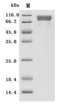 (Tris-Glycine gel) Discontinuous SDS-PAGE (reduced) with 5% enrichment gel and 15% separation gel.