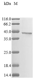 (Tris-Glycine gel) Discontinuous SDS-PAGE (reduced) with 5% enrichment gel and 15% separation gel.
