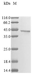 (Tris-Glycine gel) Discontinuous SDS-PAGE (reduced) with 5% enrichment gel and 15% separation gel.