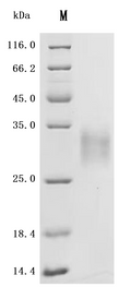 (Tris-Glycine gel) Discontinuous SDS-PAGE (reduced) with 5% enrichment gel and 15% separation gel.
