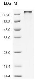(Tris-Glycine gel) Discontinuous SDS-PAGE (reduced) with 5% enrichment gel and 15% separation gel.
