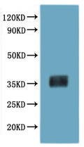 Recombinant Mouse Melanocyte-stimulating hormone receptor (Mc1r)-VLPs – Figure 1 of 1