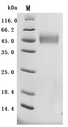 (Tris-Glycine gel) Discontinuous SDS-PAGE (reduced) with 5% enrichment gel and 15% separation gel.