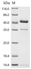 (Tris-Glycine gel) Discontinuous SDS-PAGE (reduced) with 5% enrichment gel and 15% separation gel.