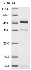 (Tris-Glycine gel) Discontinuous SDS-PAGE (reduced) with 5% enrichment gel and 15% separation gel.