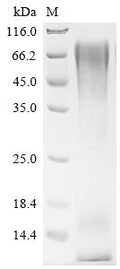 (Tris-Glycine gel) Discontinuous SDS-PAGE (reduced) with 5% enrichment gel and 15% separation gel.