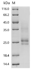 (Tris-Glycine gel) Discontinuous SDS-PAGE (reduced) with 5% enrichment gel and 15% separation gel.