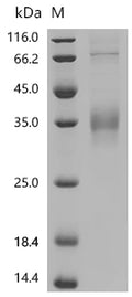 (Tris-Glycine gel) Discontinuous SDS-PAGE (reduced) with 5% enrichment gel and 15% separation gel.