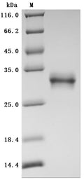(Tris-Glycine gel) Discontinuous SDS-PAGE (reduced) with 5% enrichment gel and 15% separation gel.