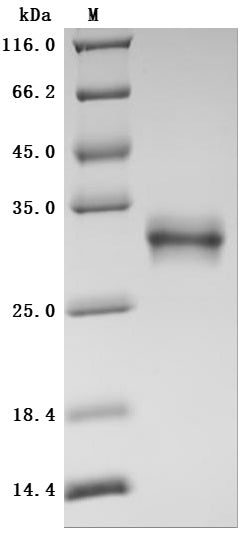 (Tris-Glycine gel) Discontinuous SDS-PAGE (reduced) with 5% enrichment gel and 15% separation gel.