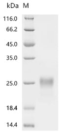 (Tris-Glycine gel) Discontinuous SDS-PAGE (reduced) with 5% enrichment gel and 15% separation gel.