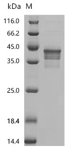 (Tris-Glycine gel) Discontinuous SDS-PAGE (reduced) with 5% enrichment gel and 15% separation gel.