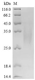 (Tris-Glycine gel) Discontinuous SDS-PAGE (reduced) with 5% enrichment gel and 15% separation gel.