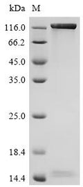 (Tris-Glycine gel) Discontinuous SDS-PAGE (reduced) with 5% enrichment gel and 15% separation gel.