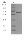 (Tris-Glycine gel) Discontinuous SDS-PAGE (reduced) with 5% enrichment gel and 15% separation gel.