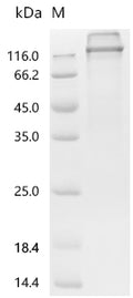 (Tris-Glycine gel) Discontinuous SDS-PAGE (reduced) with 5% enrichment gel and 15% separation gel.