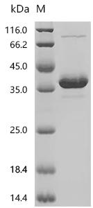 (Tris-Glycine gel) Discontinuous SDS-PAGE (reduced) with 5% enrichment gel and 15% separation gel.