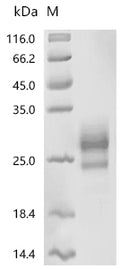 (Tris-Glycine gel) Discontinuous SDS-PAGE (reduced) with 5% enrichment gel and 15% separation gel.