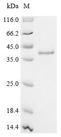 (Tris-Glycine gel) Discontinuous SDS-PAGE (reduced) with 5% enrichment gel and 15% separation gel.