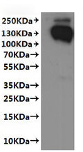 CSB-MP021581HU(F2)-C is detected by Mouse anti-6*His monoclonal antibody.