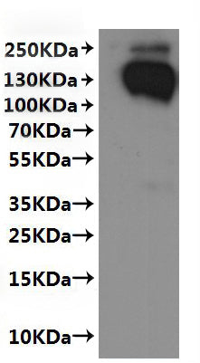 CSB-MP021581HU(F2)-C is detected by Mouse anti-6*His monoclonal antibody.