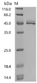 (Tris-Glycine gel) Discontinuous SDS-PAGE (reduced) with 5% enrichment gel and 15% separation gel.