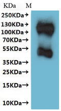 CSB-MP022726HU is detected by Mouse anti-6*His monoclonal antibody.