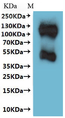 CSB-MP022726HU is detected by Mouse anti-6*His monoclonal antibody.