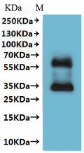CSB-MP022727HU is detected by Mouse anti-6*His monoclonal antibody.