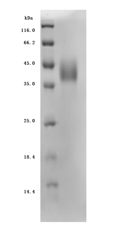 (Tris-Glycine gel) Discontinuous SDS-PAGE (reduced) with 5% enrichment gel and 15% separation gel.