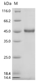 (Tris-Glycine gel) Discontinuous SDS-PAGE (reduced) with 5% enrichment gel and 15% separation gel.