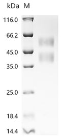 (Tris-Glycine gel) Discontinuous SDS-PAGE (reduced) with 5% enrichment gel and 15% separation gel.