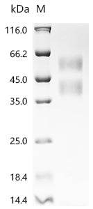 (Tris-Glycine gel) Discontinuous SDS-PAGE (reduced) with 5% enrichment gel and 15% separation gel.