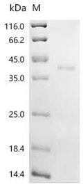 (Tris-Glycine gel) Discontinuous SDS-PAGE (reduced) with 5% enrichment gel and 15% separation gel.