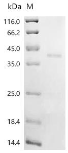 (Tris-Glycine gel) Discontinuous SDS-PAGE (reduced) with 5% enrichment gel and 15% separation gel.