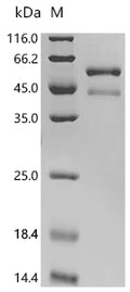 (Tris-Glycine gel) Discontinuous SDS-PAGE (reduced) with 5% enrichment gel and 15% separation gel.