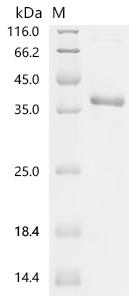 (Tris-Glycine gel) Discontinuous SDS-PAGE (reduced) with 5% enrichment gel and 15% separation gel.