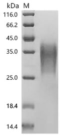 (Tris-Glycine gel) Discontinuous SDS-PAGE (reduced) with 5% enrichment gel and 15% separation gel.