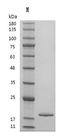 Recombinant Human Tumor necrosis factor (TNF), partial (Active) – Figure 1 of 1